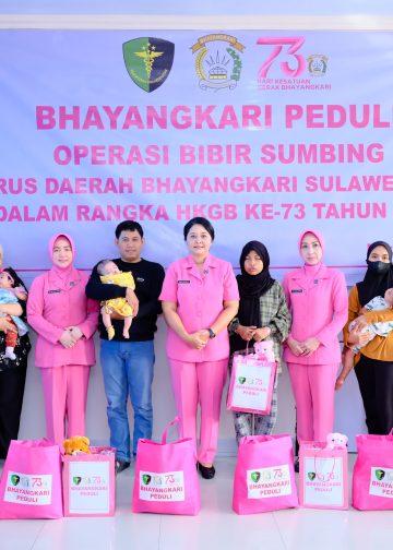 Ketua Bhayangkari Daerah Sulsel Gelar Bakti Kesehatan Operasi Bibir Sumbing di RS Bhayangkara Makassar